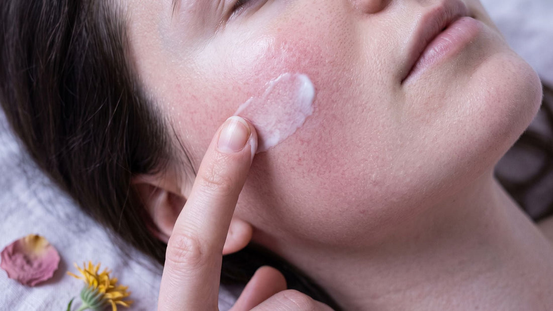 How to Reduce Redness on Your Face