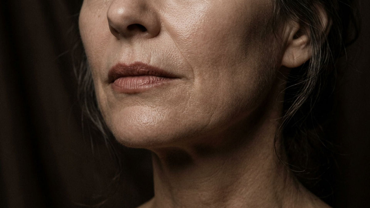 How to reduce nasolabial folds around nose and mouth
